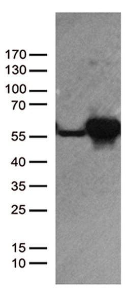 DDX39B Monoclonal Antibody (OTI2G7), TrueMAB , OriGene 30 &mu;L; Unconjugated:Antibodies,