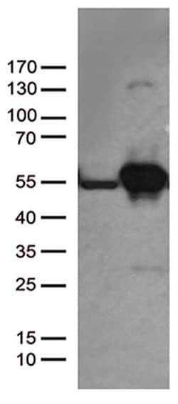 DDX39B Monoclonal Antibody (OTI7H4), TrueMAB , OriGene 100 &mu;L | Buy Online | OriGene | Fisher Scientific