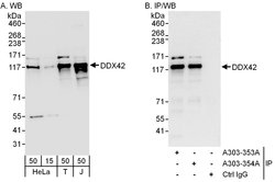 DDX42 Rabbit anti-Human, Polyclonal, Bethyl Laboratories 100 &mu;l; Unlabeled:Antibodies,