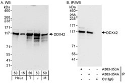 DDX42 Rabbit anti-Human, Mouse, Polyclonal, Bethyl Laboratories 100 &mu;l;