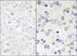 DDX46 Rabbit anti-Human, Mouse, Polyclonal, Bethyl Laboratories 100 &mu;L;