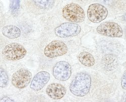 DDX46 Polyclonal Antibody, Bethyl Laboratories 10 &mu;L; Unconjugated:Antibodies,