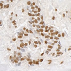 DDX5 Rabbit anti-Human, Mouse, Polyclonal, Bethyl Laboratories 100 &mu;L;