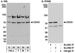 DDX5 Rabbit anti-Human, Polyclonal, Bethyl Laboratories 100 &mu;L; Unconjugated:Antibodies,