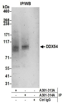DDX54 Rabbit anti-Human, Polyclonal, Bethyl Laboratories 100 &mu;L; Unconjugated:Antibodies,