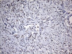DDX56 Monoclonal Antibody (OTI5C1), TrueMAB , OriGene 100 &mu;L; Unconjugated:Antibodies,