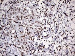 DDX56 Monoclonal Antibody (OTI5C1), TrueMAB , OriGene 100 &mu;L; Unconjugated:Antibodies,