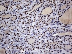 DDX56 Monoclonal Antibody (OTI11H7), TrueMAB , OriGene 100 &mu;L; Unconjugated:Antibodies,