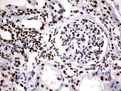 DDX56 Monoclonal Antibody (OTI11H7), TrueMAB , OriGene 100 &mu;L; Unconjugated:Antibodies,