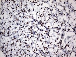 DDX56 Monoclonal Antibody (OTI11H7), TrueMAB , OriGene 100 &mu;L; Unconjugated:Antibodies,