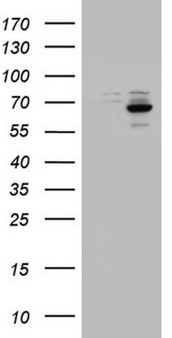 DDX56 Monoclonal Antibody (OTI5C1), TrueMAB , OriGene 100 &mu;L; Unconjugated:Antibodies,