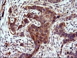 DDX58 Monoclonal Antibody (OTI7D5), TrueMAB , OriGene 100 &mu;L; Unconjugated:Antibodies,