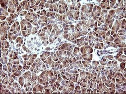 DDX58 Monoclonal Antibody (OTI7D5), TrueMAB , OriGene 100 &mu;L; Unconjugated:Antibodies,