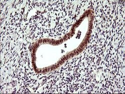 DDX58 Monoclonal Antibody (OTI7D5), TrueMAB , OriGene 100 &mu;L; Unconjugated:Antibodies,