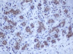 DDX59 Mouse anti-Human, Clone: OTI2G1, lyophilized, TrueMAB 100 &mu;g;