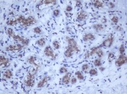 DDX59 Monoclonal Antibody (OTI2G1), TrueMAB , OriGene 100 &mu;L | Buy Online | OriGene | Fisher Scientific