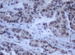 DDX59 Mouse anti-Human, Clone: OTI2G1, lyophilized, TrueMAB 100 &mu;g;