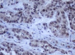 DDX59 Monoclonal Antibody (OTI2G1), TrueMAB , OriGene 100 &mu;L | Buy Online | OriGene | Fisher Scientific