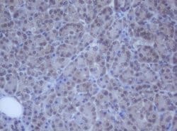 DDX59 Mouse anti-Human, Clone: OTI2G1, lyophilized, TrueMAB 100 &mu;g;