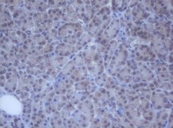 DDX59 Monoclonal Antibody (OTI2G1), TrueMAB , OriGene 100 &mu;L | Buy Online | OriGene | Fisher Scientific