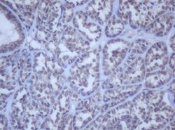 DDX59 Monoclonal Antibody (OTI2G1), TrueMAB , OriGene 100 &mu;L | Buy Online | OriGene | Fisher Scientific