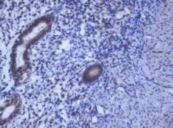 DDX59 Mouse anti-Human, Clone: OTI2G1, lyophilized, TrueMAB 100 &mu;g;