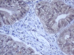DDX59 Mouse anti-Human, Clone: OTI2G1, lyophilized, TrueMAB 100 &mu;g;