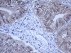 DDX59 Monoclonal Antibody (OTI2G1), TrueMAB , OriGene 100 &mu;L | Buy Online | OriGene | Fisher Scientific