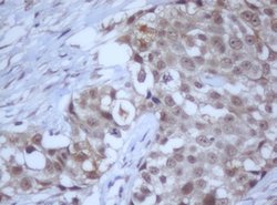 DDX59 Mouse anti-Human, Clone: OTI2G1, lyophilized, TrueMAB 100 &mu;g;