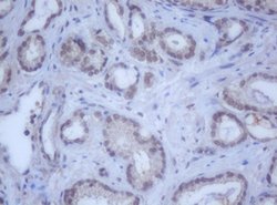 DDX59 Mouse anti-Human, Clone: OTI2G1, lyophilized, TrueMAB 100 &mu;g;