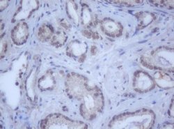 DDX59 Monoclonal Antibody (OTI2G1), TrueMAB , OriGene 100 &mu;L | Buy Online | OriGene | Fisher Scientific