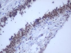 DDX59 Mouse anti-Human, Clone: OTI2G1, lyophilized, TrueMAB 100 &mu;g;
