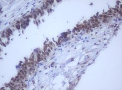DDX59 Monoclonal Antibody (OTI2G1), TrueMAB , OriGene 100 &mu;L | Buy Online | OriGene | Fisher Scientific