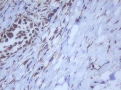DDX59 Monoclonal Antibody (OTI2G1), TrueMAB , OriGene 100 &mu;L | Buy Online | OriGene | Fisher Scientific