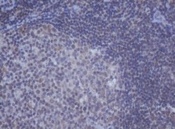 DDX59 Mouse anti-Human, Clone: OTI2G1, lyophilized, TrueMAB 100 &mu;g;