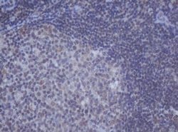 DDX59 Monoclonal Antibody (OTI2G1), TrueMAB , OriGene 100 &mu;L | Buy Online | OriGene | Fisher Scientific