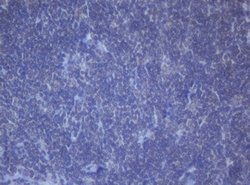 DDX59 Mouse anti-Human, Clone: OTI2G1, lyophilized, TrueMAB 100 &mu;g;