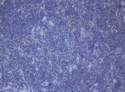 DDX59 Monoclonal Antibody (OTI2G1), TrueMAB , OriGene 100 &mu;L | Buy Online | OriGene | Fisher Scientific