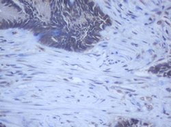DDX59 Monoclonal Antibody (OTI2G1), TrueMAB , OriGene 100 &mu;L | Buy Online | OriGene | Fisher Scientific