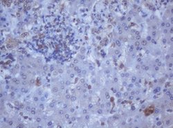 DDX59 Mouse anti-Human, Clone: OTI2G1, lyophilized, TrueMAB 100 &mu;g;