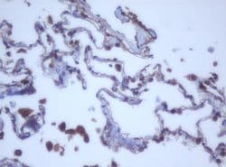 DDX59 Mouse anti-Human, Clone: OTI2G1, lyophilized, TrueMAB 100 &mu;g;
