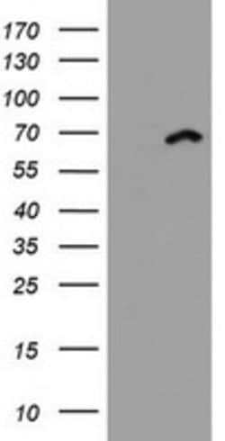 DDX59 Mouse anti-Human, Clone: OTI3F8, lyophilized, TrueMAB 100 &mu;g;