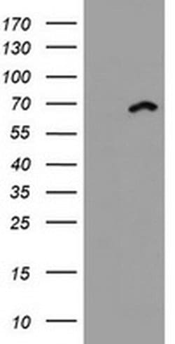 DDX59 Monoclonal Antibody (OTI3F8), TrueMAB , OriGene:Antibodies:Primary