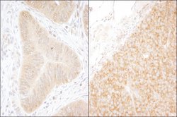 DDX6 Rabbit anti-Human, Mouse, Polyclonal, Bethyl Laboratories 100 &mu;L;