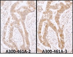 DDX6 Rabbit anti-Human, Mouse, Polyclonal, Bethyl Laboratories 100 &mu;L;