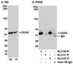 DDX6 Rabbit anti-Human, Mouse, Polyclonal, Bethyl Laboratories 100 &mu;L;