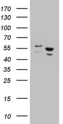DDX6 Monoclonal Antibody (OTI3B7), TrueMAB , OriGene 100 &mu;L; Unconjugated:Antibodies,