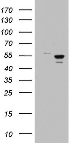 DDX6 Monoclonal Antibody (OTI3E2), TrueMAB , OriGene 30 &mu;L; Unconjugated:Antibodies,
