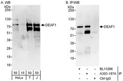 DEAF1 Rabbit anti-Human, Polyclonal, Bethyl Laboratories 100 &mu;L; Unconjugated:Antibodies,