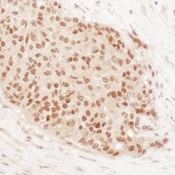 DEC1 Rabbit anti-Human, Polyclonal, Bethyl Laboratories 100 &mu;L; Unconjugated:Antibodies,